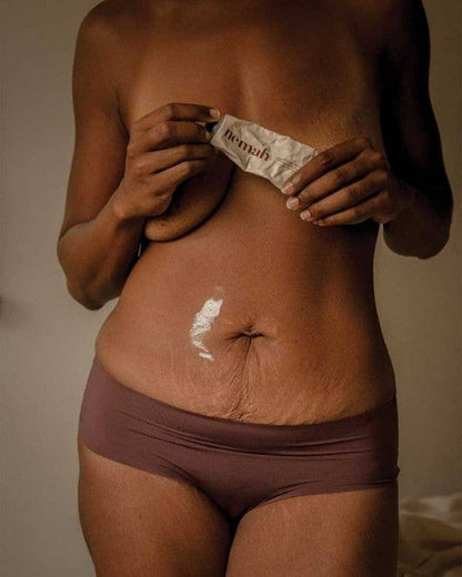 Revitalizing Stretch Mark Cream – Skin Repair & Hydration
