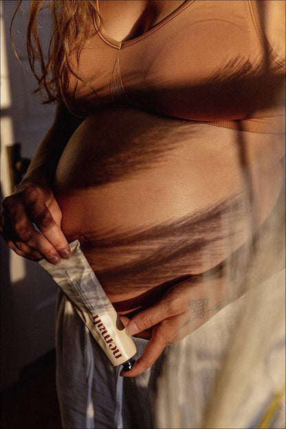 Revitalizing Stretch Mark Cream – Skin Repair & Hydration